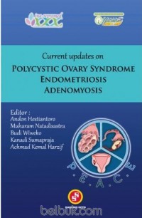 current updates on polycystic ovary syndrome