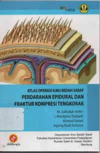 Atlas Operasi Ilmu Bedah Saraf Pendarahan Epidural Dan Fraktur Kompresi Tengkorak