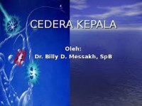Cedera Kepala